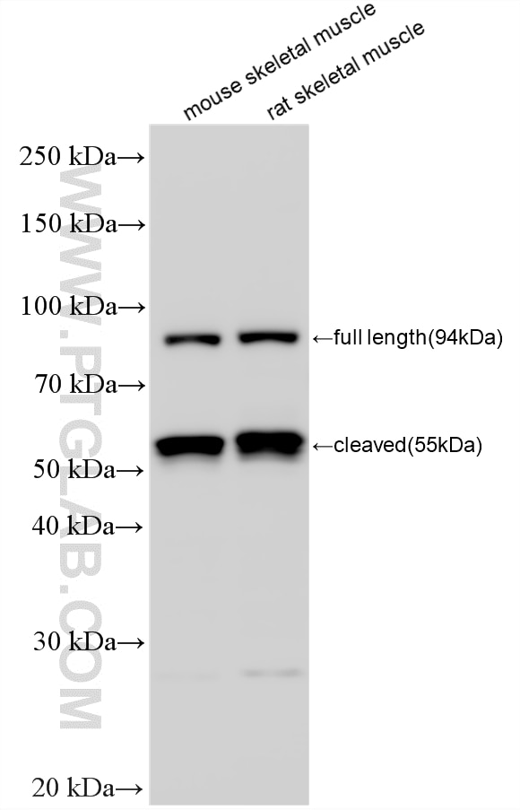 Western Blot (WB) analysis of various lysates using Calpain 3 Polyclonal antibody (28476-1-AP)
