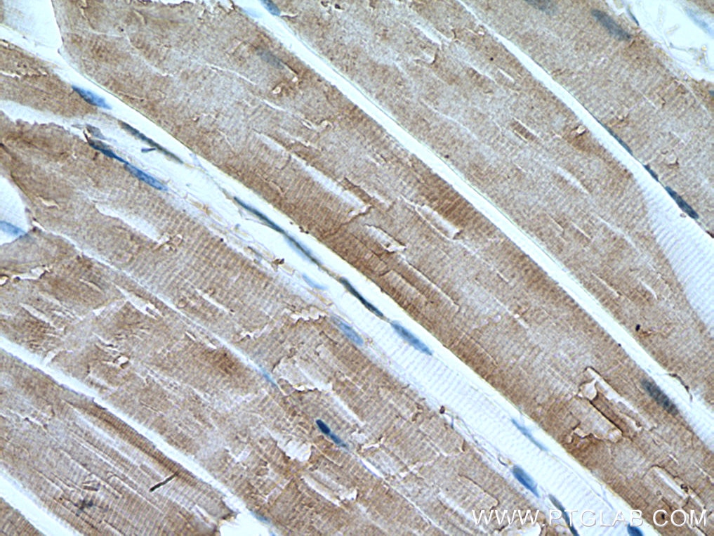 Immunohistochemistry (IHC) staining of mouse skeletal muscle tissue using CAPN3 Monoclonal antibody (67366-1-Ig)