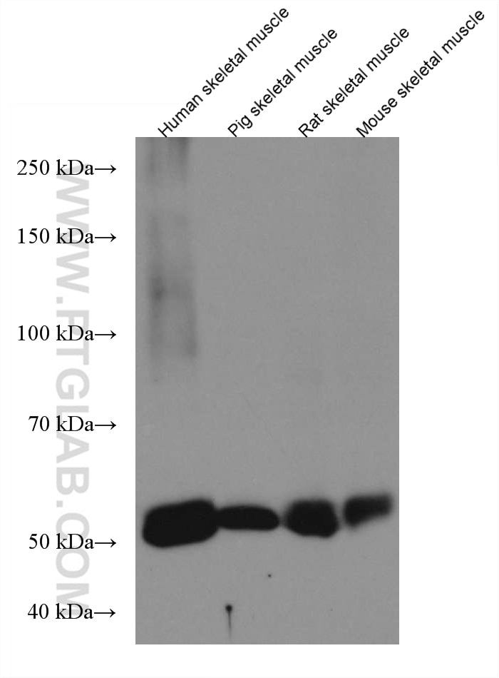 Western Blot (WB) analysis of various lysates using CAPN3 Monoclonal antibody (67366-1-Ig)