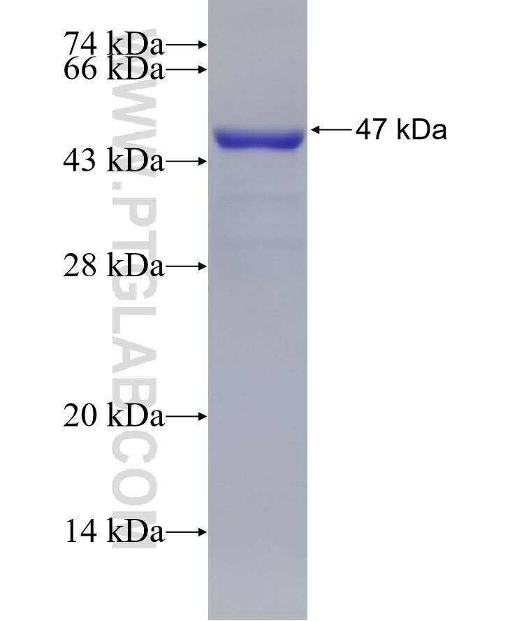 CAPN3 fusion protein Ag29454 SDS-PAGE