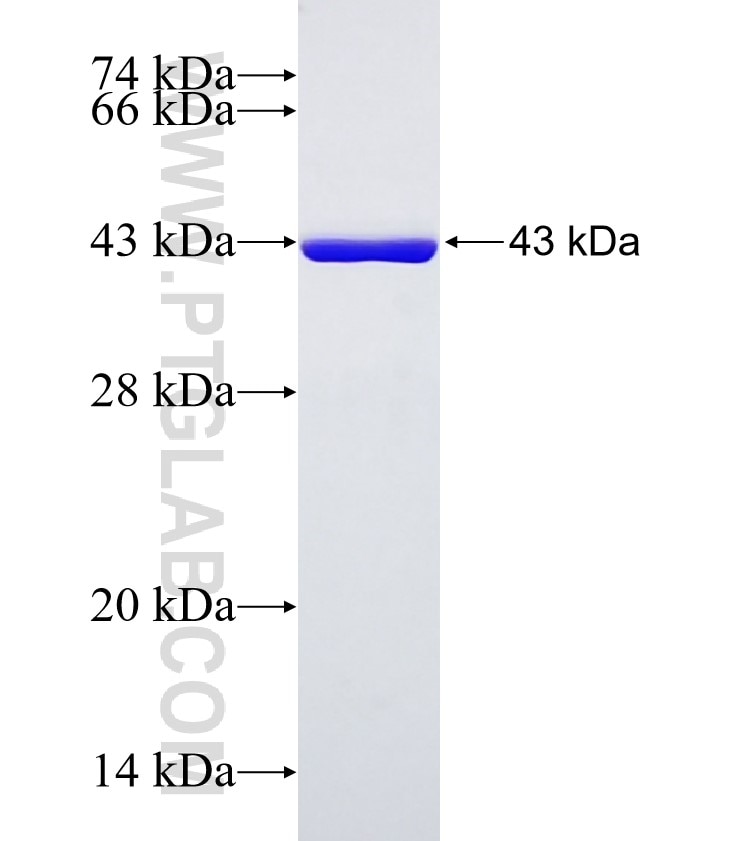 CAPN3 fusion protein Ag0671 SDS-PAGE