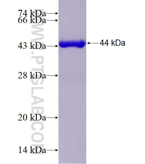 CAPN3 fusion protein Ag0760 SDS-PAGE