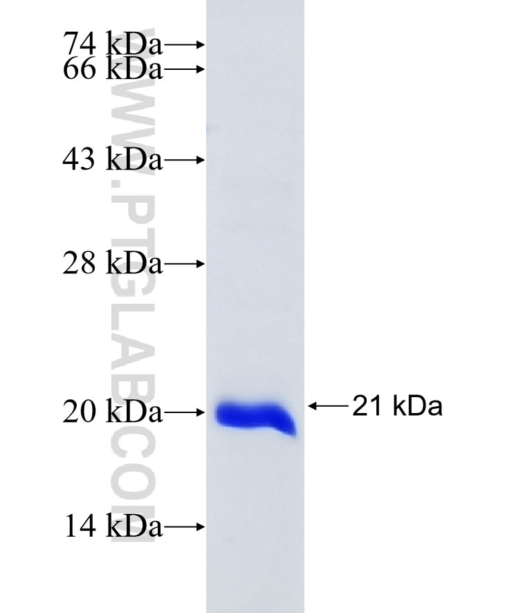 CAPN3 fusion protein Ag13179 SDS-PAGE