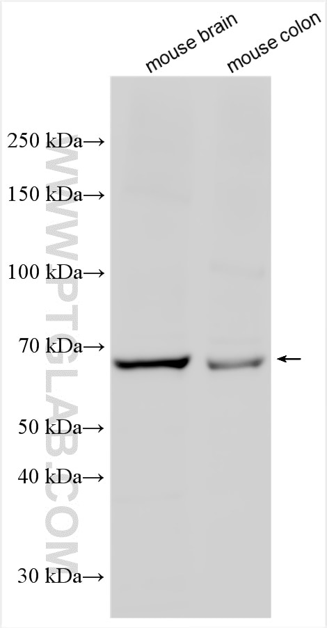 Western Blot (WB) analysis of various lysates using CAPN5 Polyclonal antibody (29809-1-AP)