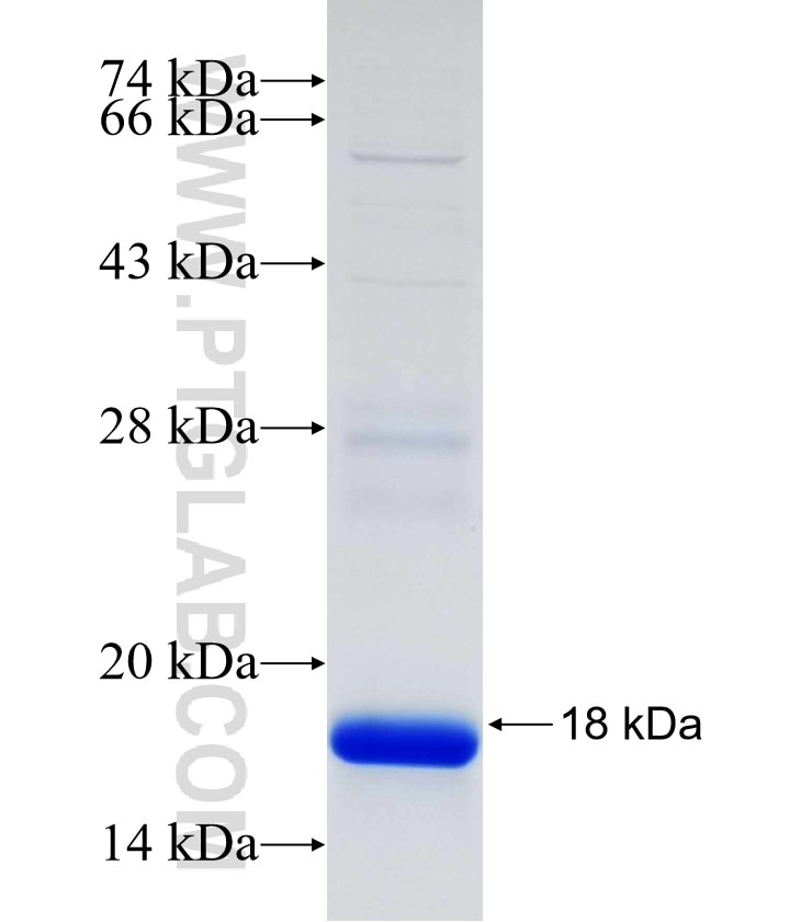 CAPN5 fusion protein Ag30479 SDS-PAGE