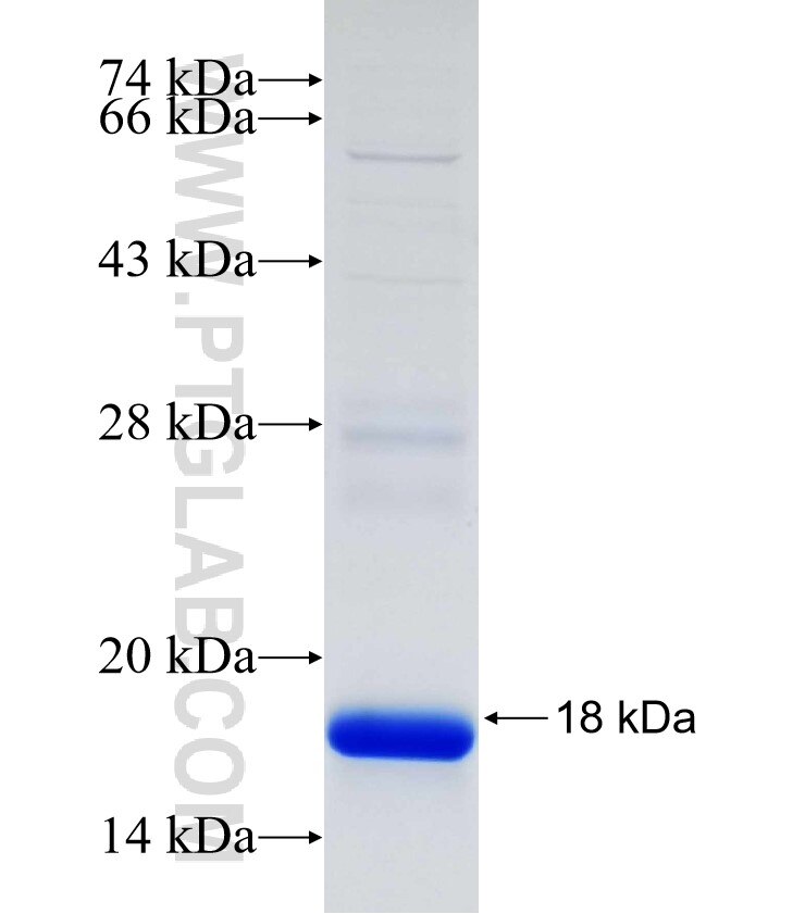 CAPN5 fusion protein Ag30479 SDS-PAGE