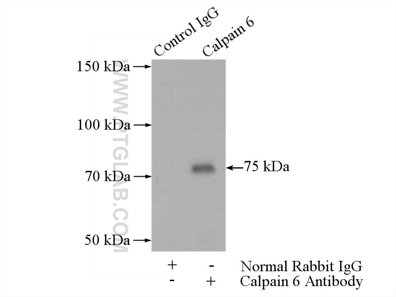Immunoprecipitation (IP) experiment of human placenta tissue using Calpain 6 Polyclonal antibody (10120-1-AP)