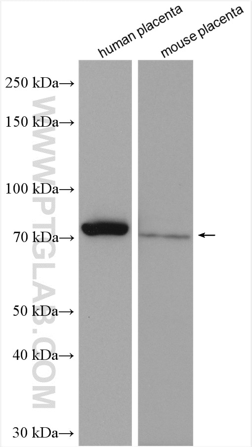 Western Blot (WB) analysis of various lysates using Calpain 6 Polyclonal antibody (10120-1-AP)