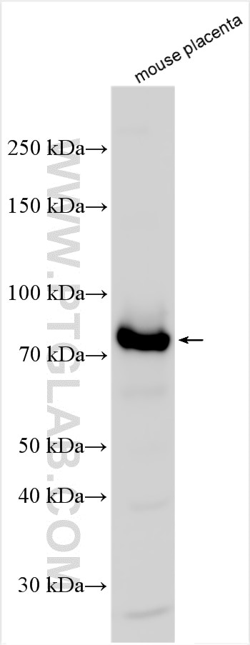 Western Blot (WB) analysis of various lysates using Calpain 6 Polyclonal antibody (10120-1-AP)