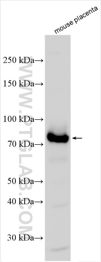 WB analysis using 10120-1-AP