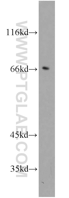 Western Blot (WB) analysis of A549 cells using Calpain 6 Polyclonal antibody (10120-1-AP)