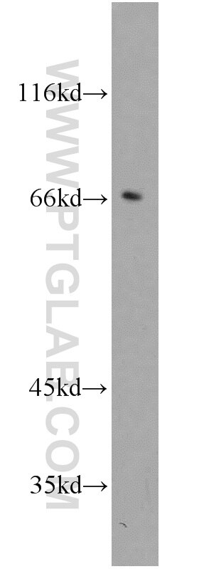 Western Blot (WB) analysis of A549 cells using Calpain 6 Polyclonal antibody (10120-1-AP)