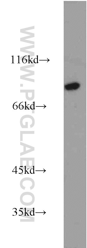 Western Blot (WB) analysis of human heart tissue using Calpain 7 Polyclonal antibody (13870-1-AP)