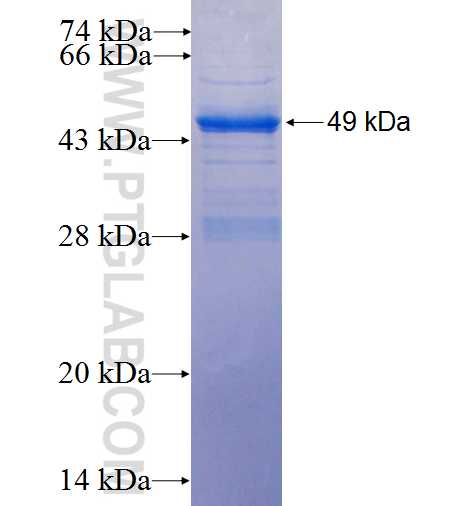 CAPN7 fusion protein Ag25574 SDS-PAGE