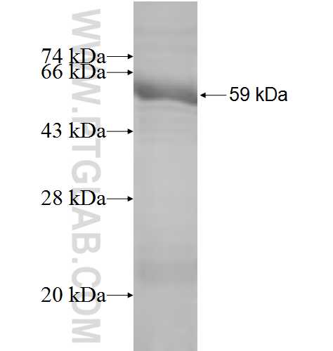 CAPN7 fusion protein Ag4820 SDS-PAGE