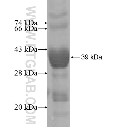 CAPN7 fusion protein Ag4943 SDS-PAGE