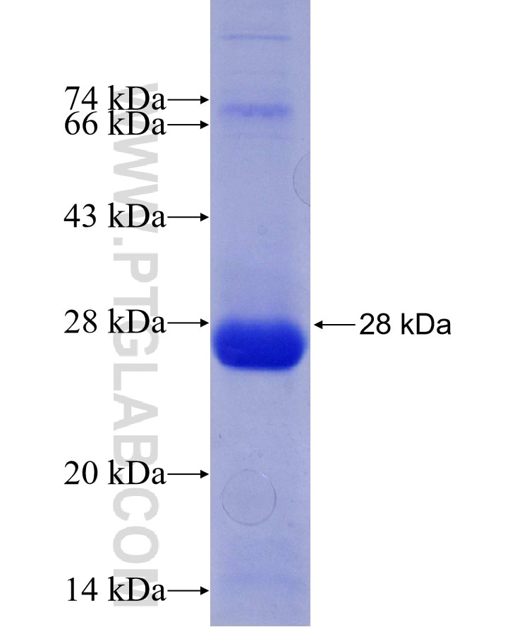 CAPN8 fusion protein Ag29594 SDS-PAGE