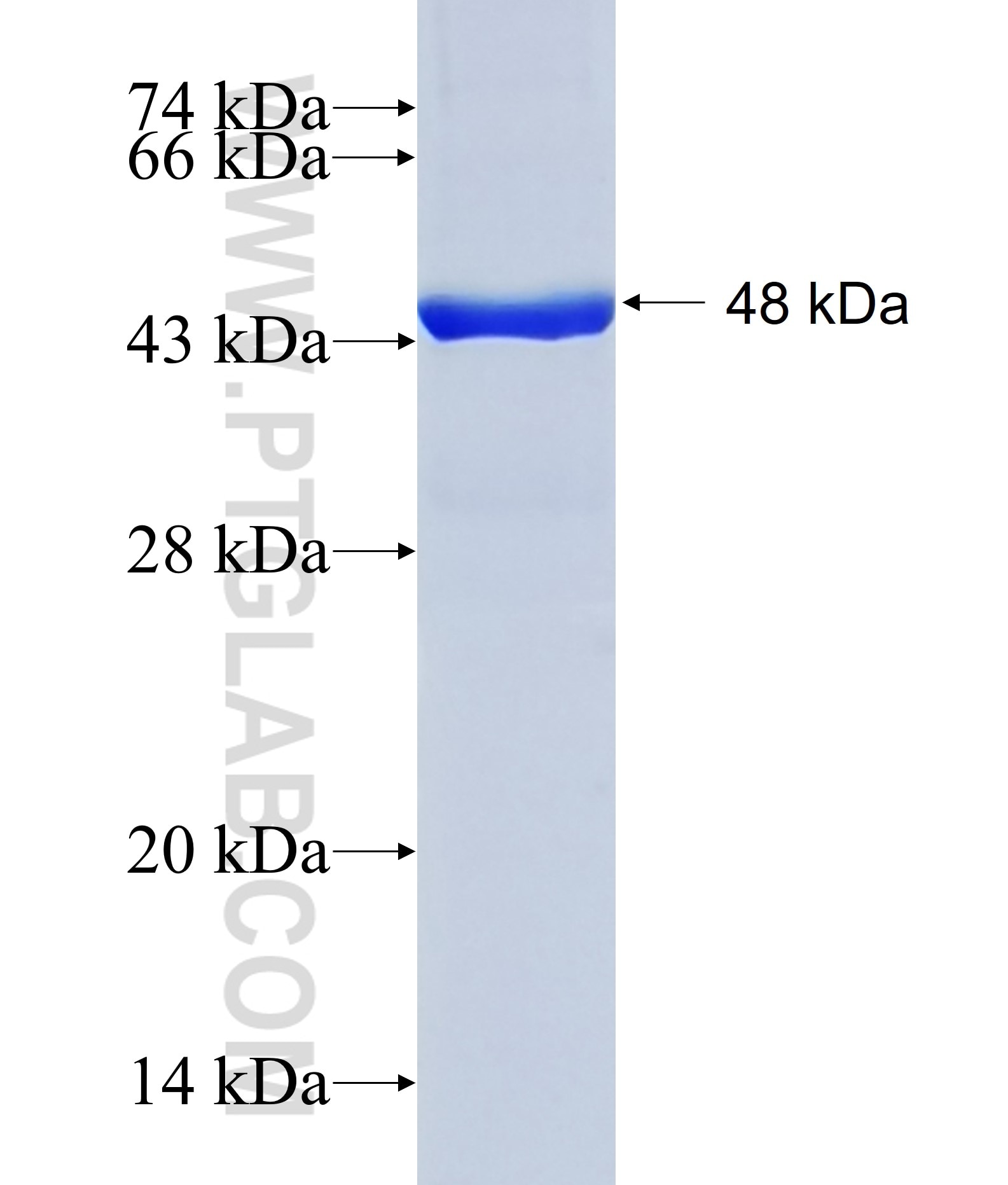 CAPN8 fusion protein Ag29846 SDS-PAGE CAPN8 fusion protein Ag29846 SDS-PAGE