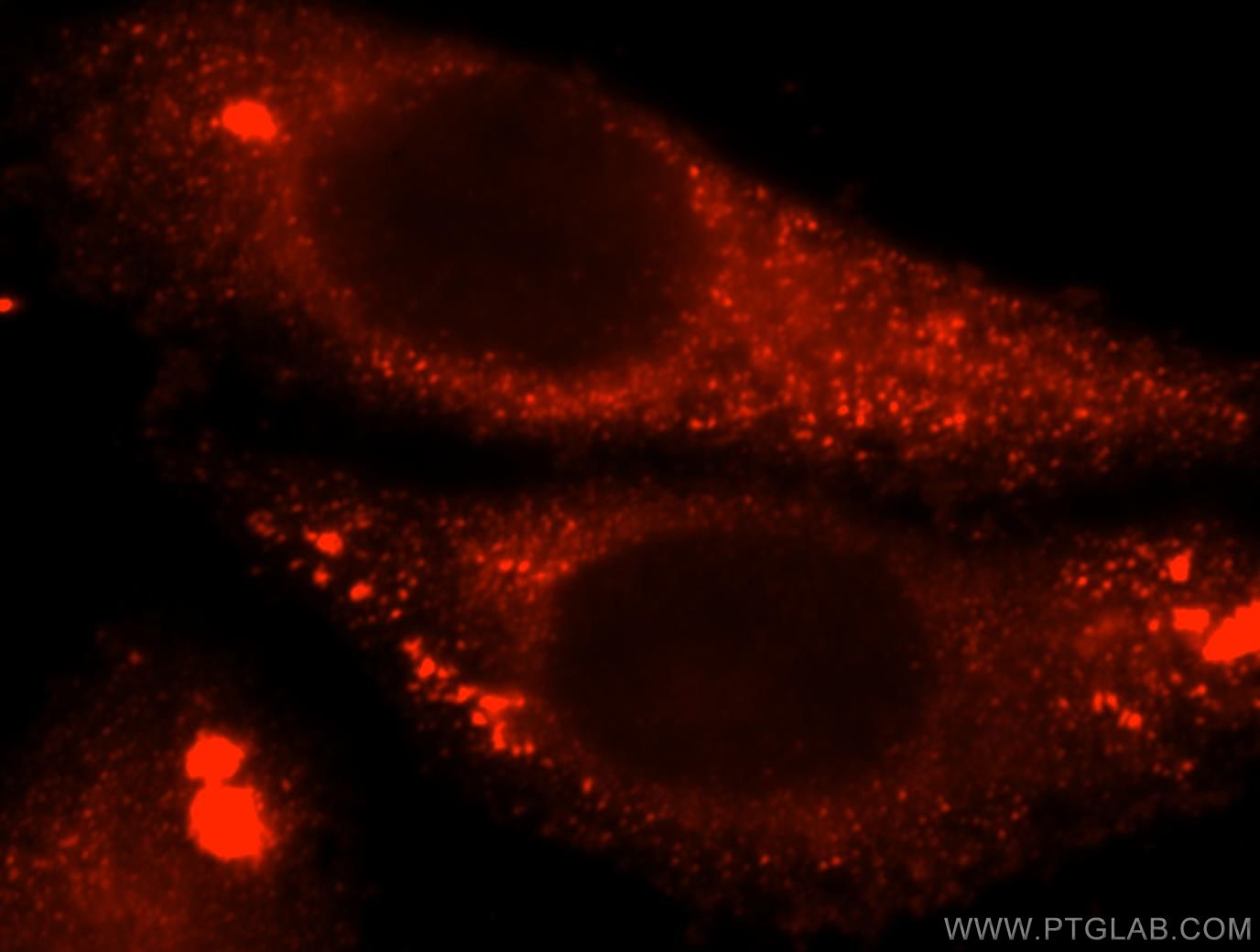 Immunofluorescence (IF) / fluorescent staining of HepG2 cells using Calpain 9 Polyclonal antibody (17556-1-AP)