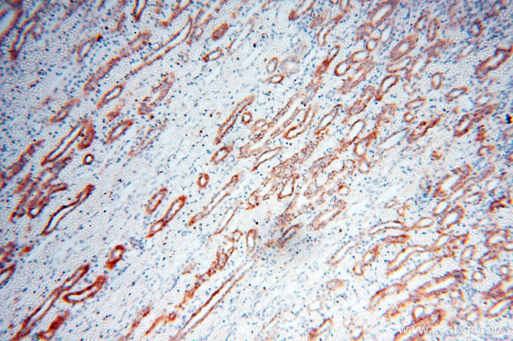 Immunohistochemistry (IHC) staining of human kidney tissue using Calpain 9 Polyclonal antibody (17556-1-AP)
