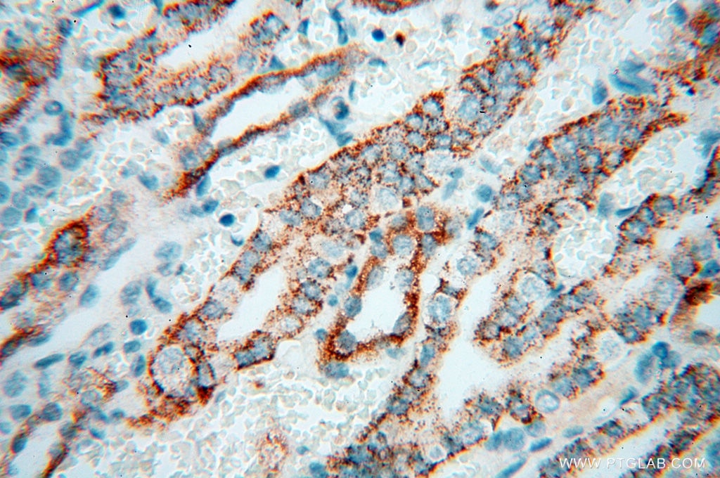 Immunohistochemistry (IHC) staining of human kidney tissue using Calpain 9 Polyclonal antibody (17556-1-AP)