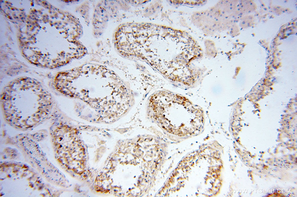 Immunohistochemistry (IHC) staining of human testis tissue using Calpain 9 Polyclonal antibody (17556-1-AP)