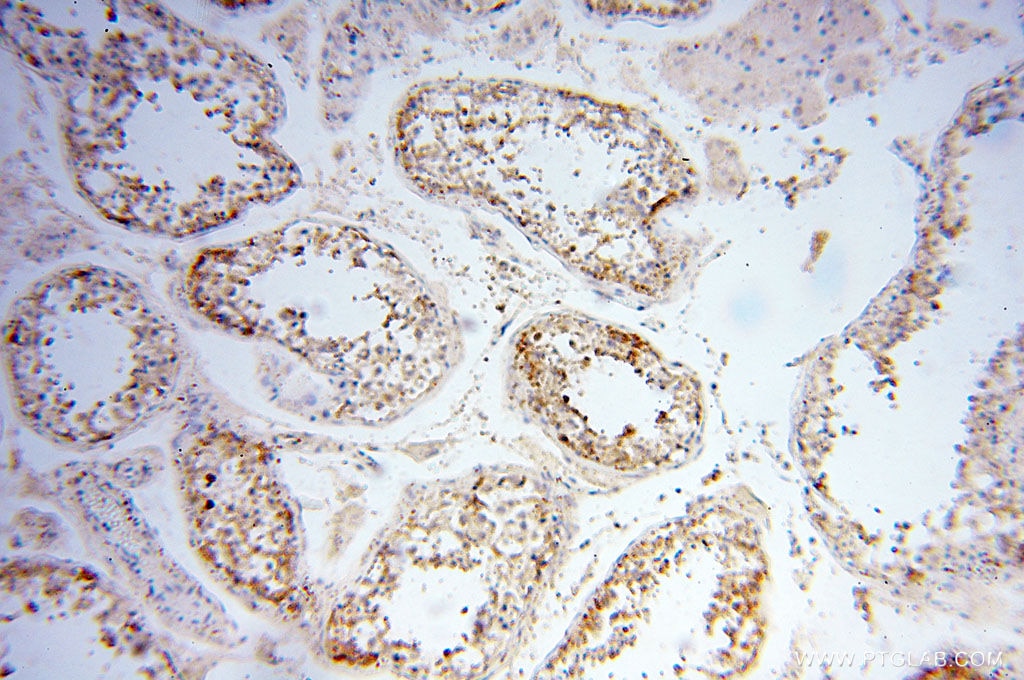 IHC staining of human testis using 17556-1-AP