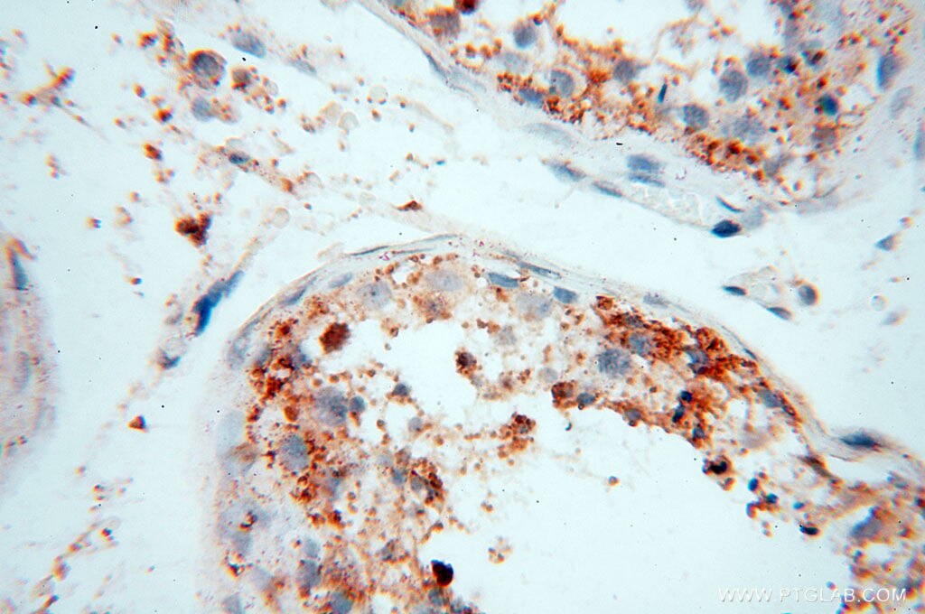 IHC staining of human testis using 17556-1-AP