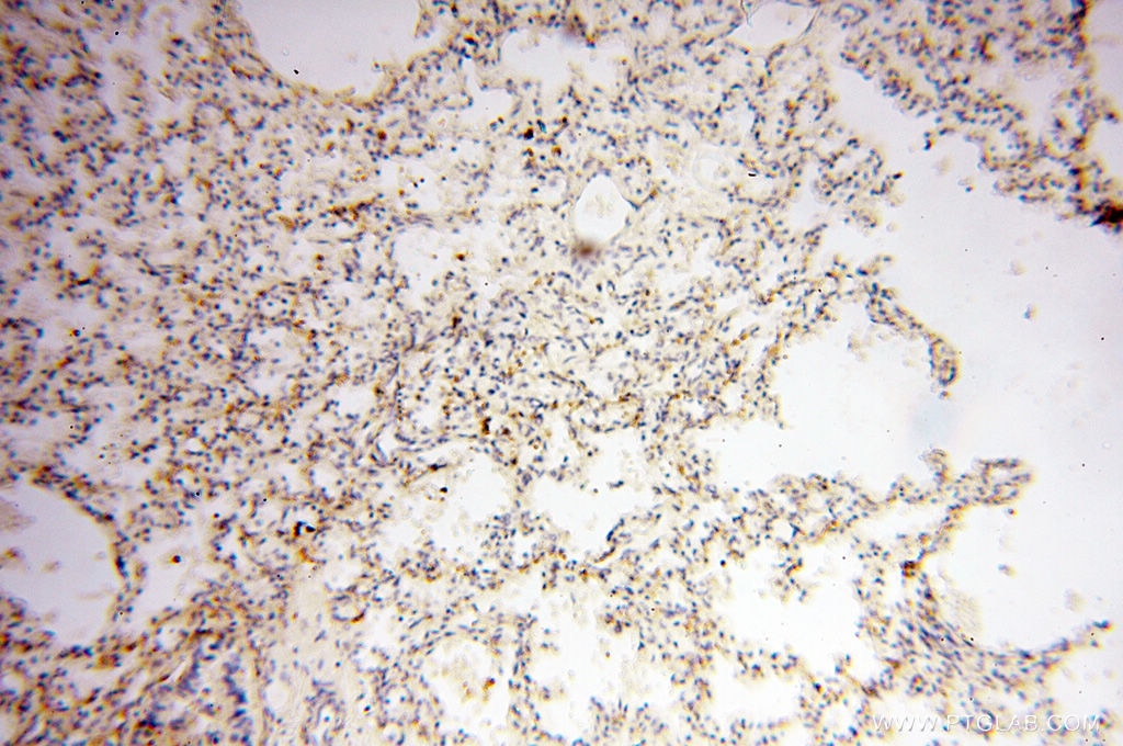 Immunohistochemistry (IHC) staining of human lung tissue using Calpain 9 Polyclonal antibody (17556-1-AP)