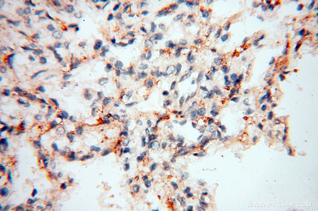 Immunohistochemistry (IHC) staining of human lung tissue using Calpain 9 Polyclonal antibody (17556-1-AP)