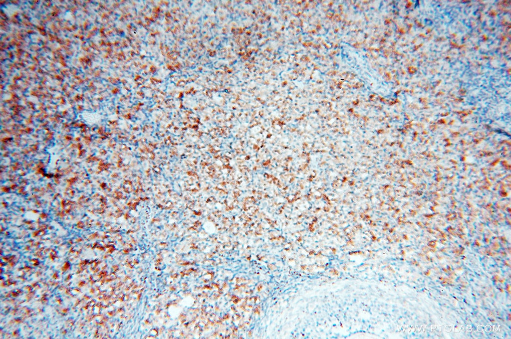 Immunohistochemistry (IHC) staining of human ovary tissue using Calpain 9 Polyclonal antibody (17556-1-AP)