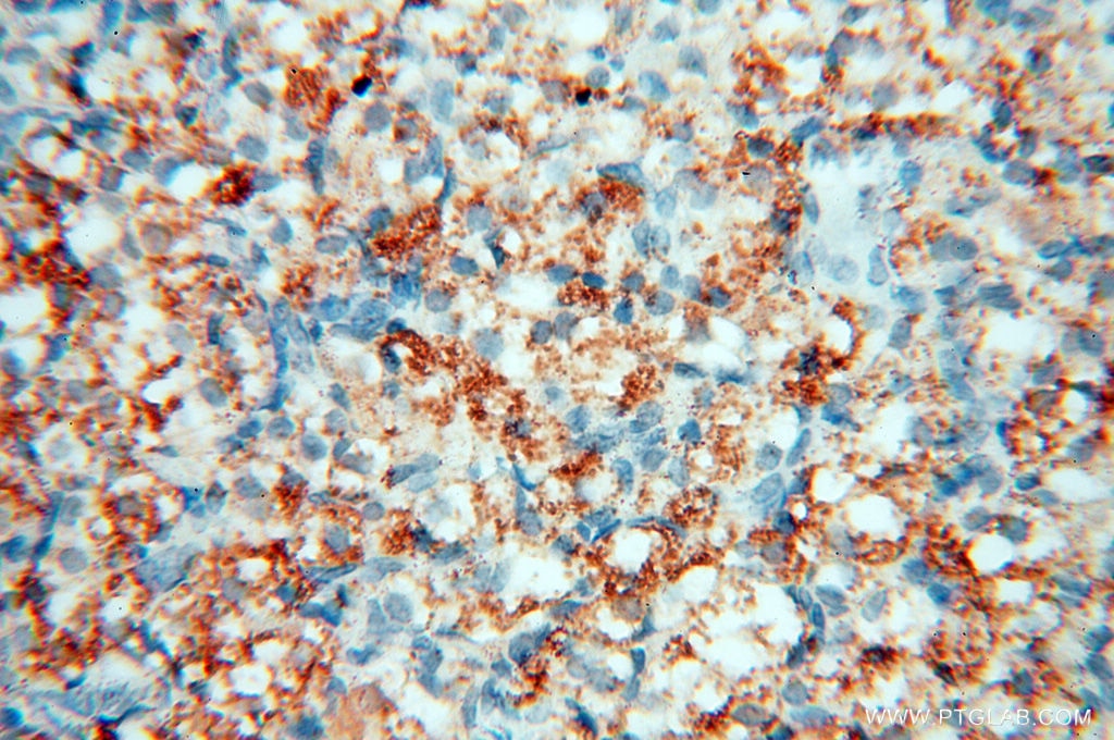 Immunohistochemistry (IHC) staining of human ovary tissue using Calpain 9 Polyclonal antibody (17556-1-AP)