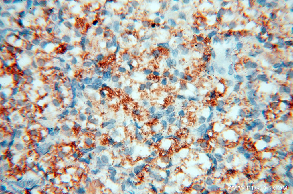 IHC staining of human ovary using 17556-1-AP