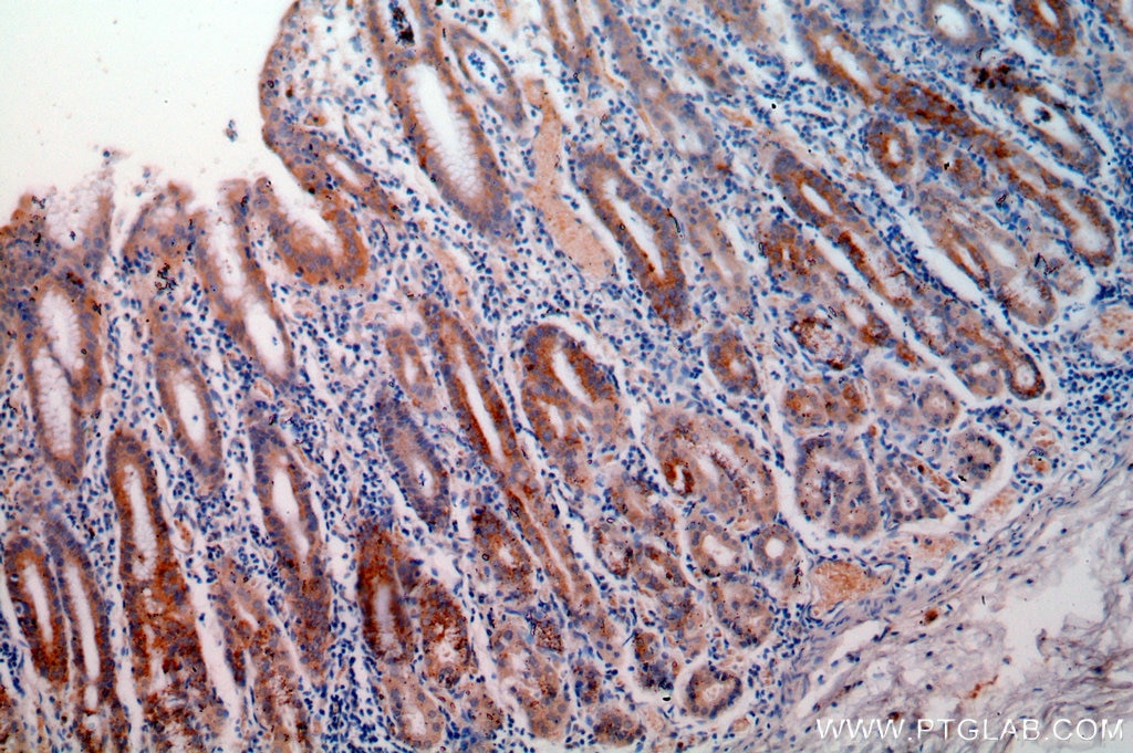 Immunohistochemistry (IHC) staining of human stomach tissue using Calpain 9 Polyclonal antibody (17556-1-AP)