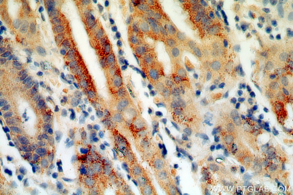 Immunohistochemistry (IHC) staining of human stomach tissue using Calpain 9 Polyclonal antibody (17556-1-AP)