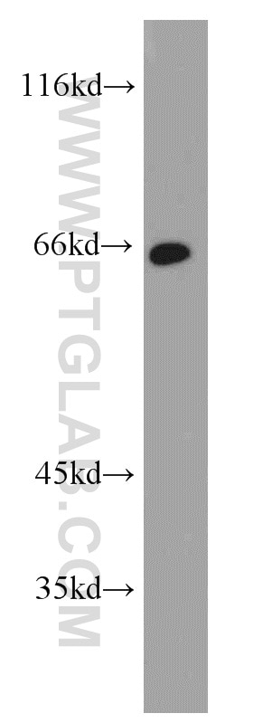 Western Blot (WB) analysis of human stomach tissue using Calpain 9 Polyclonal antibody (17556-1-AP)