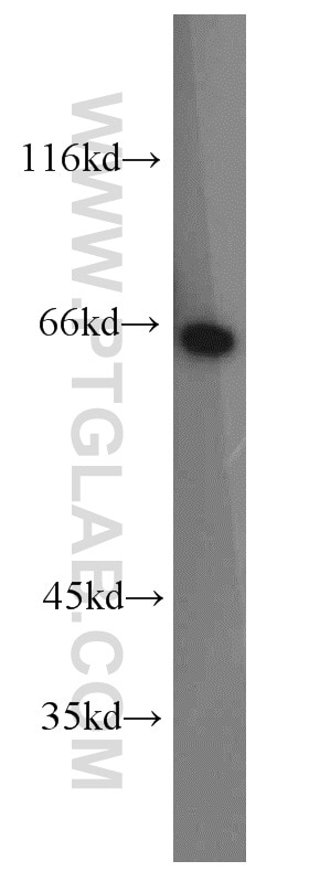 Western Blot (WB) analysis of human stomach tissue using Calpain 9 Polyclonal antibody (17556-1-AP)