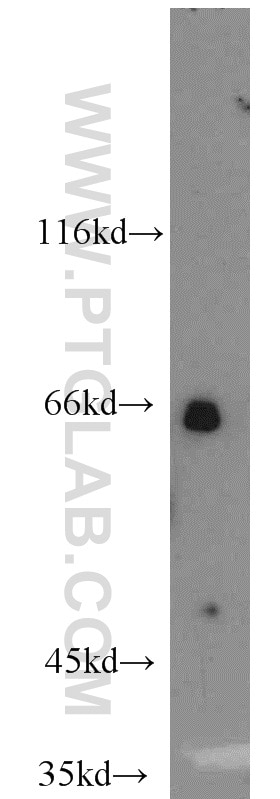 Western Blot (WB) analysis of HL-60 cells using Calpain 9 Polyclonal antibody (17556-1-AP)
