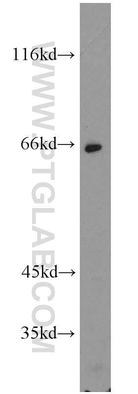 Western Blot (WB) analysis of mouse small intestine tissue using Calpain 9 Polyclonal antibody (17556-1-AP)