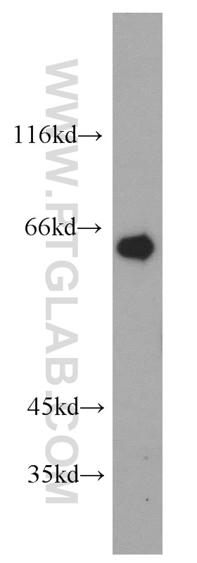 Western Blot (WB) analysis of human stomach tissue using Calpain 9 Polyclonal antibody (17556-1-AP)