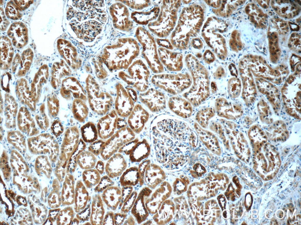 Immunohistochemistry (IHC) staining of human kidney tissue using CAPNS1 Polyclonal antibody (25057-1-AP)