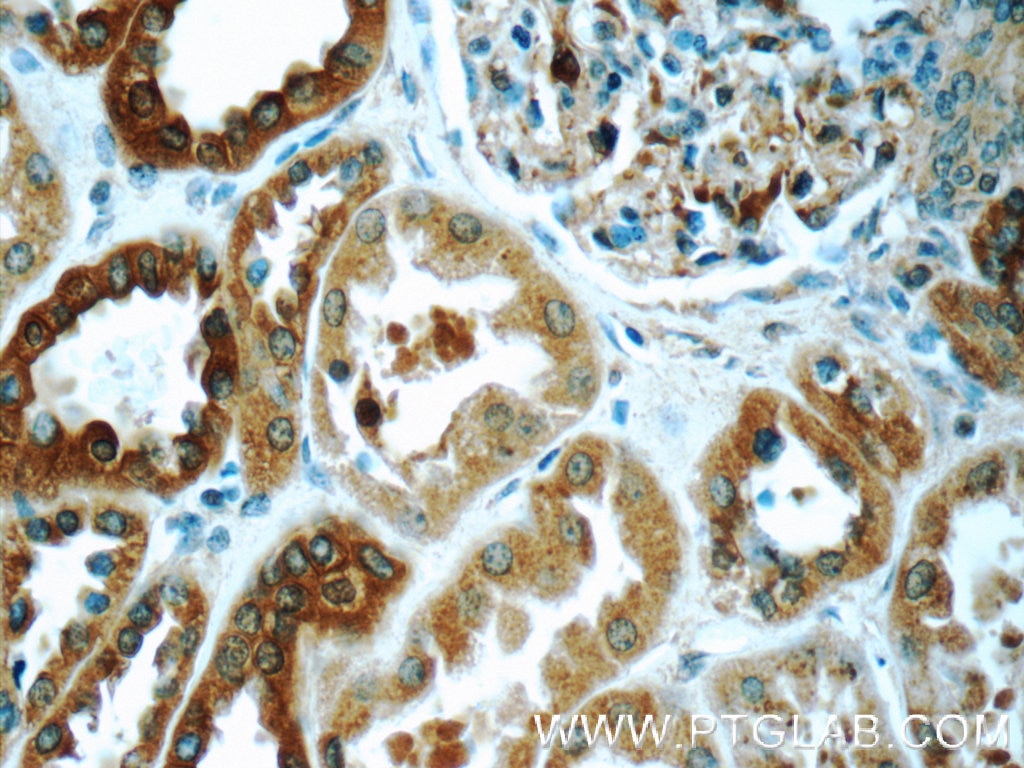 Immunohistochemistry (IHC) staining of human kidney tissue using CAPNS1 Polyclonal antibody (25057-1-AP)