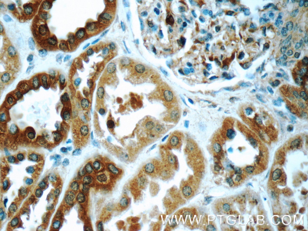 IHC staining of human kidney using 25057-1-AP