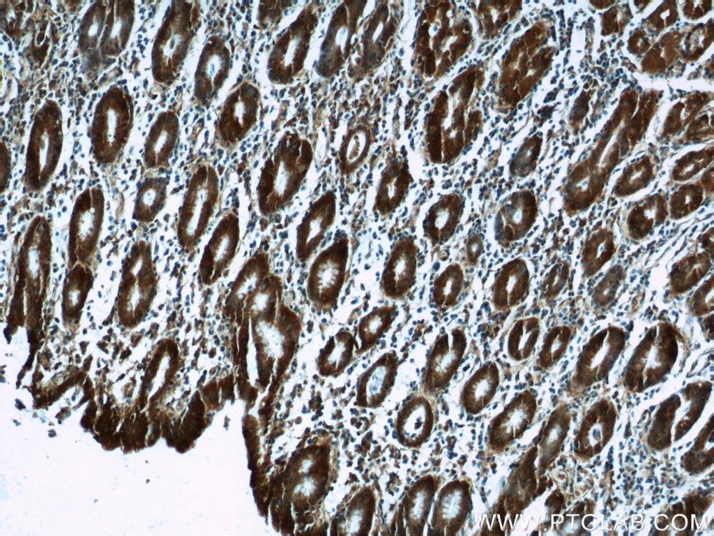 Immunohistochemistry (IHC) staining of human stomach tissue using CAPNS1 Polyclonal antibody (25057-1-AP)