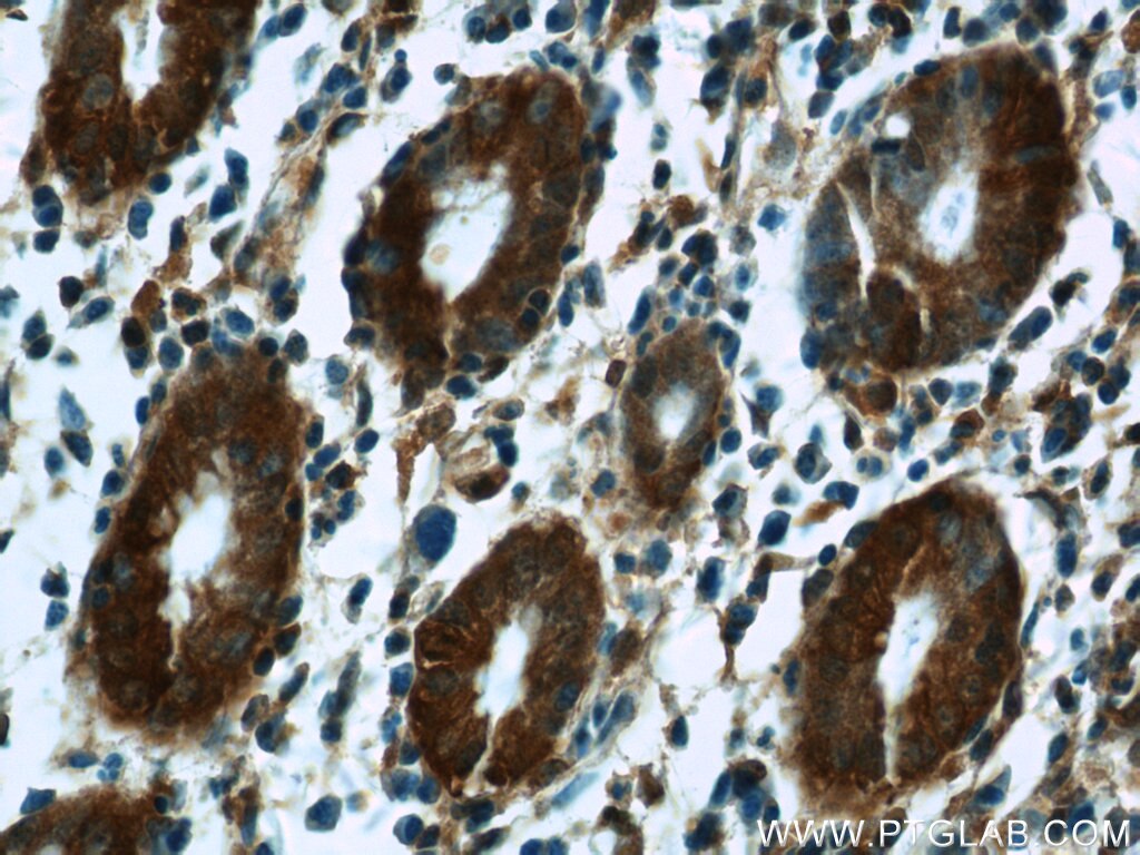 Immunohistochemistry (IHC) staining of human stomach tissue using CAPNS1 Polyclonal antibody (25057-1-AP)