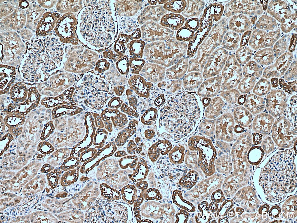 IHC staining of human kidney using 25057-1-AP