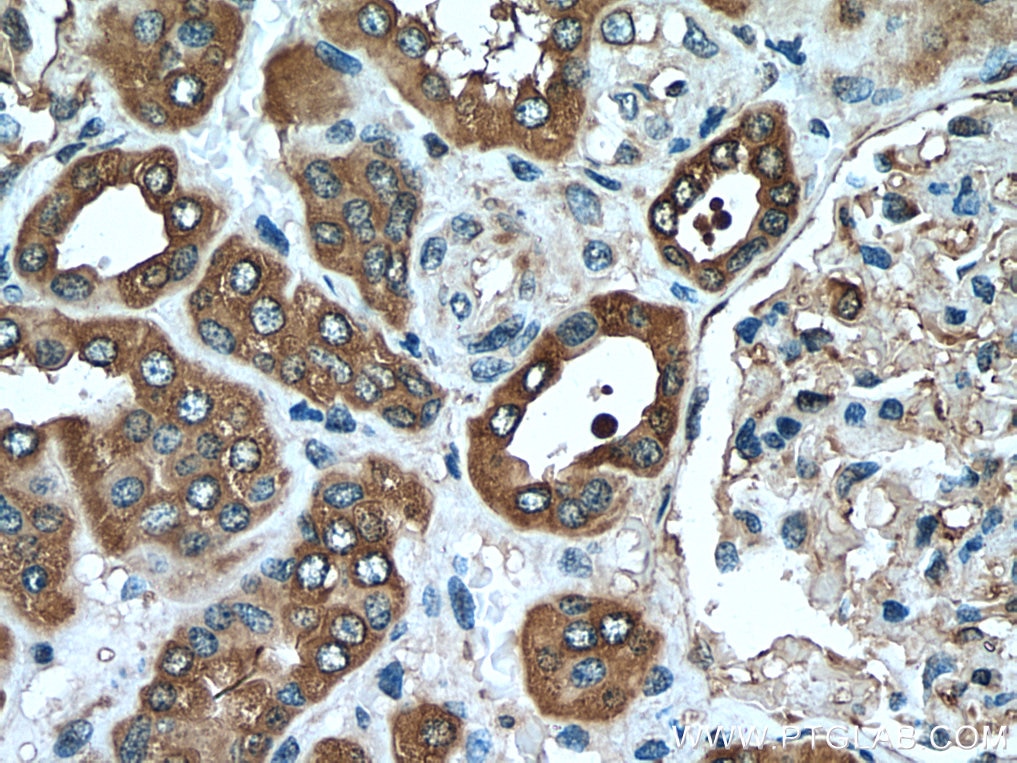 IHC staining of human kidney using 25057-1-AP