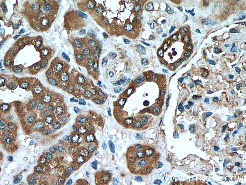 Immunohistochemistry (IHC) staining of human kidney tissue using CAPNS1 Polyclonal antibody (25057-1-AP)