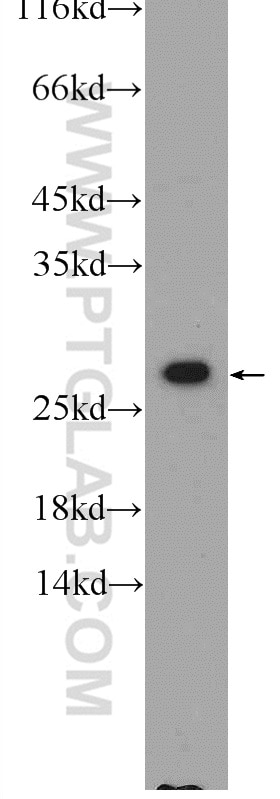 WB analysis of HEK-293 using 25057-1-AP