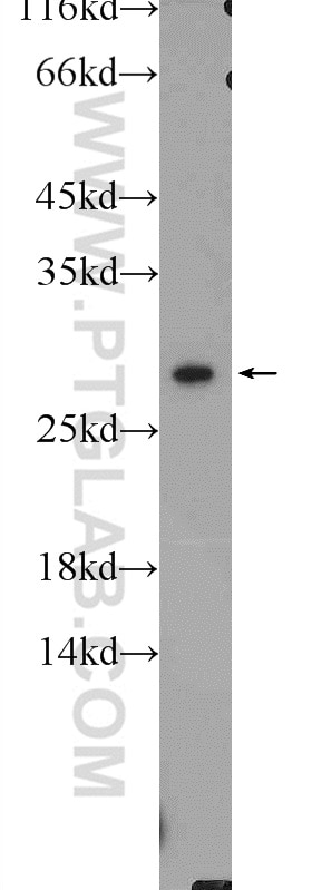 Western Blot (WB) analysis of A431 cells using CAPNS1 Polyclonal antibody (25057-1-AP)